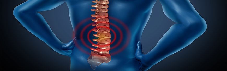 Spinal Decompression Treatment in Fremont